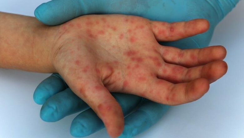  ���������� ����������� ��� ����������������� ����������� ���� 