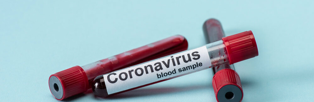  ������������� ���������������� ��������� ����������� ��� 