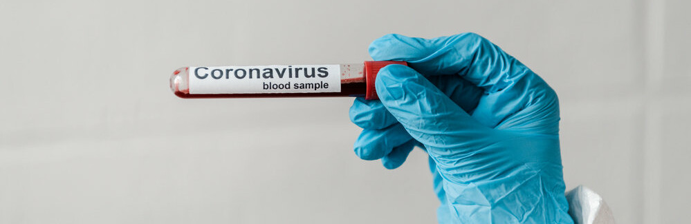  ����������� ������ ������� covid-19 �������� ���������� ���������� ���������� 