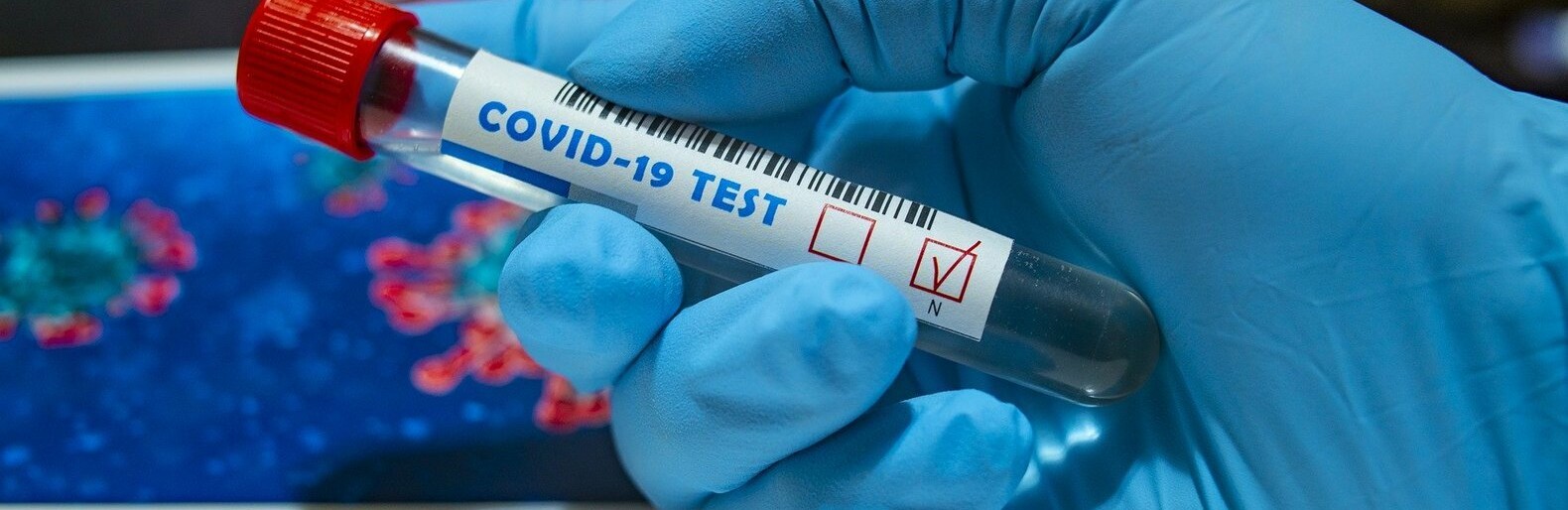  ���������� ��������� ���������� ���������� covid-19 �������� ������� ����� 