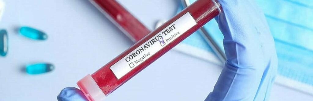  ��������� ����������� ������ ��� ��������� �������� ������� covid-19 