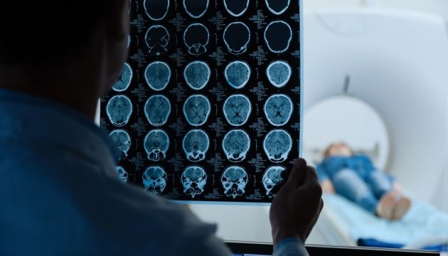 У Запоріжжі своєчасно діагностуються лише 30% онкозахворювань, - ОВА