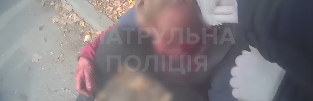У Запоріжжі патрульні поліцейські прийшли на допомогу чоловіку, що знепритомнів та вдарився головою