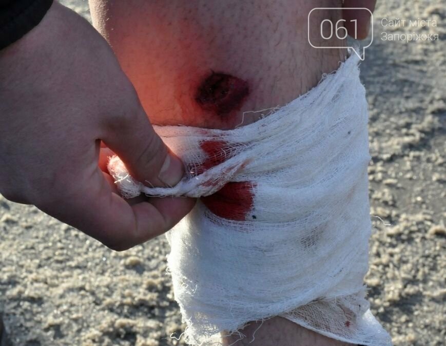 “Мы не сломались”: истории запорожцев переживших разгон Майдана в 2014 году , фото-56