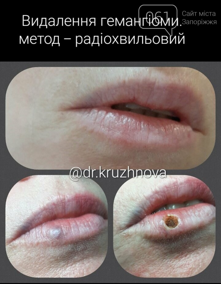 Педіатри та дитячі лікарі у Запоріжжі: де отримати якісну медичну допомогу, фото-92
