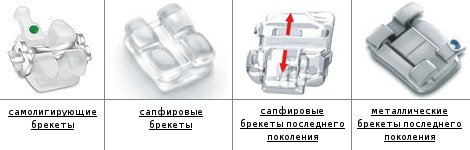 Ортодонтия в стоматологическом центре "ЛОТ", фото-1