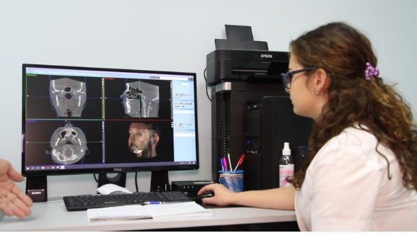 Лазерне сканування м'яких тканин обличчя (ProFace), фото-1