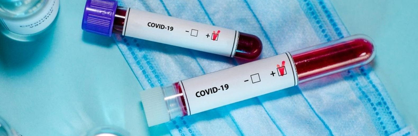 Коронавирусной болезнью COVID-19 в Украине заразились более 5000 человек, скончались - 128