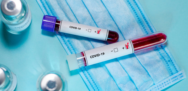 В Запорожской области от осложнений COVID-19 умерло ещё 20 человек 