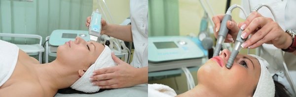 ultra_lift_pro salon krasoti v zaporoje