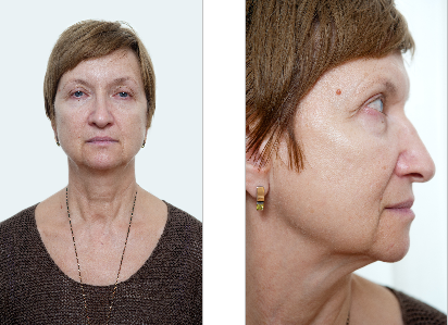 Снимок-2013-11-18 15:24:40