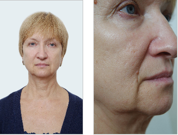 Снимок-2013-11-18 15:24:15